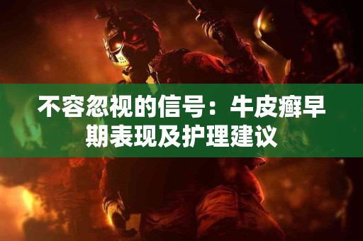 不容忽视的信号：牛皮癣早期表现及护理建议